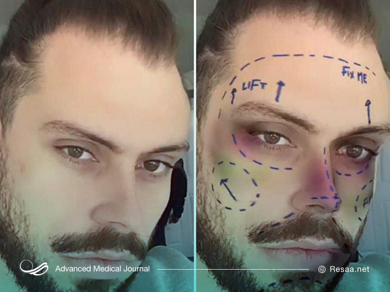 عوارض و معایب جراحی زیبایی