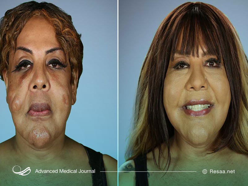 گاهی عمل زیبایی نتیجه عکس می‌دهد.