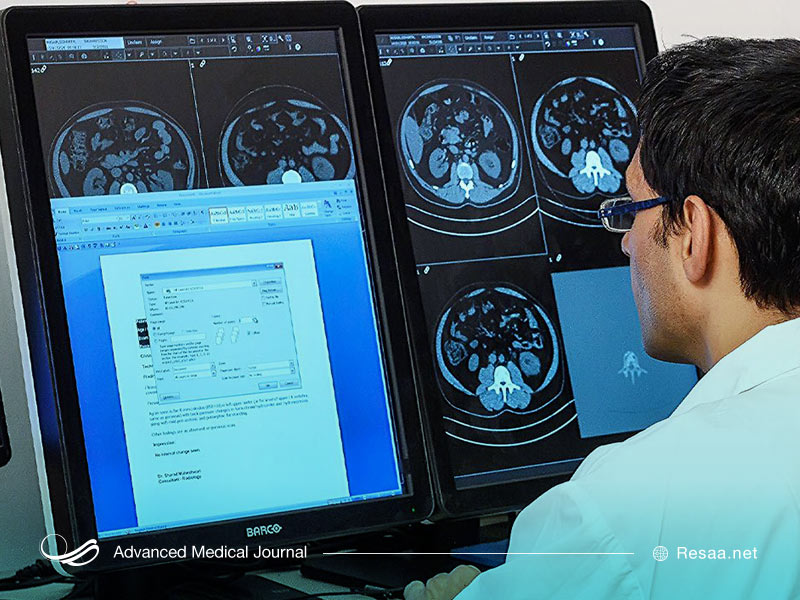 اسکن اولتراسوند