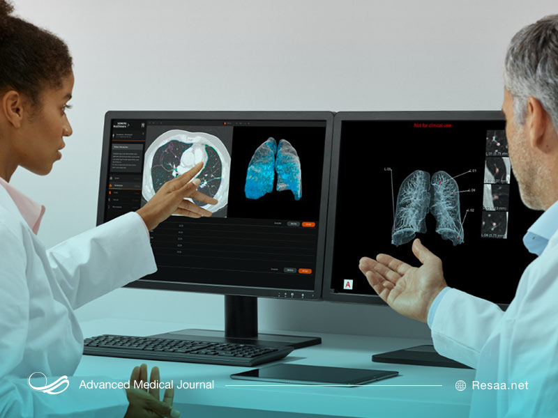 بررسی سی‌تی اسکن افراد بیمار