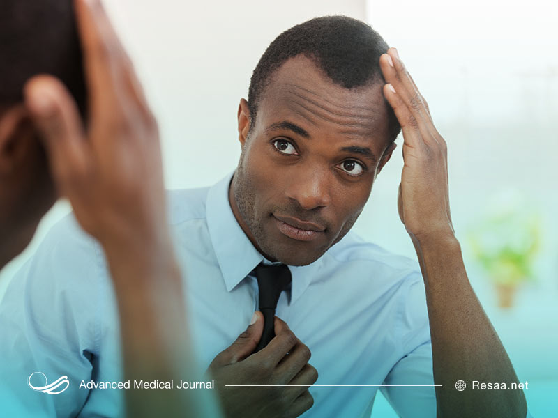 مشکلات ناشی از شوره سر