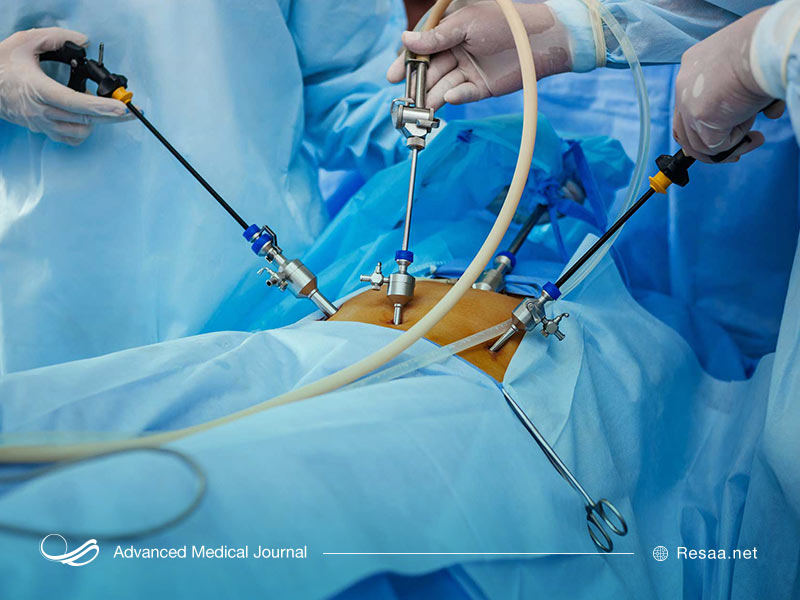 لاپاروسکوپی