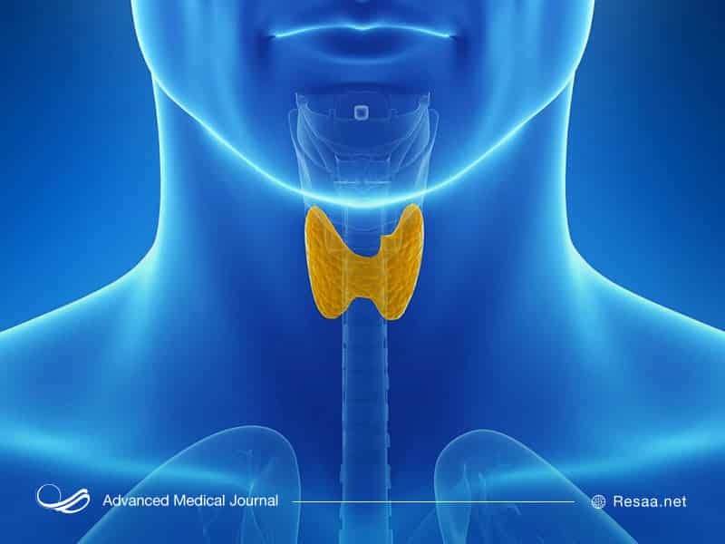 هاشیموتو در زنان بیشتر از مردان دیده شده است