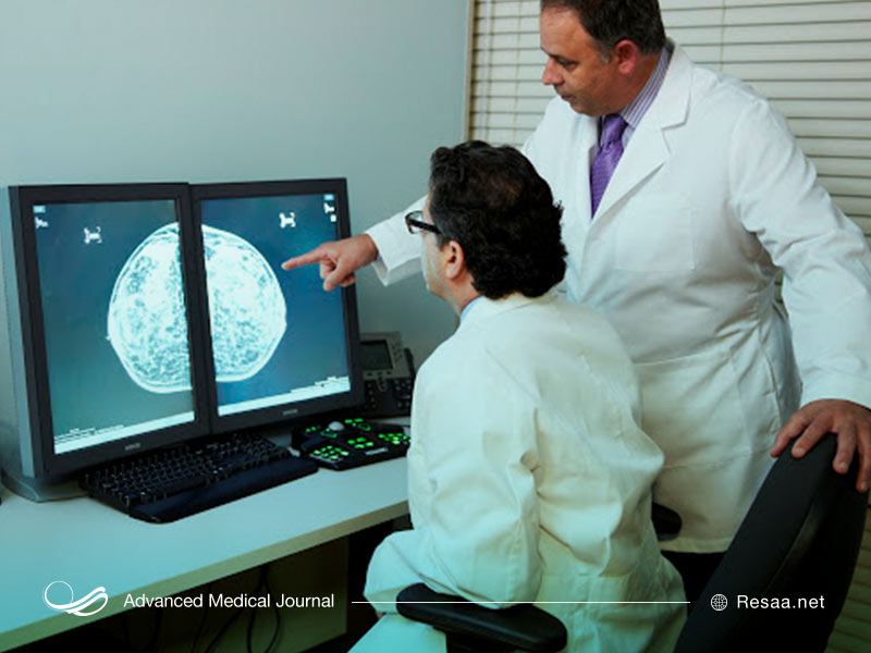 تشخیص تومورهای سینه