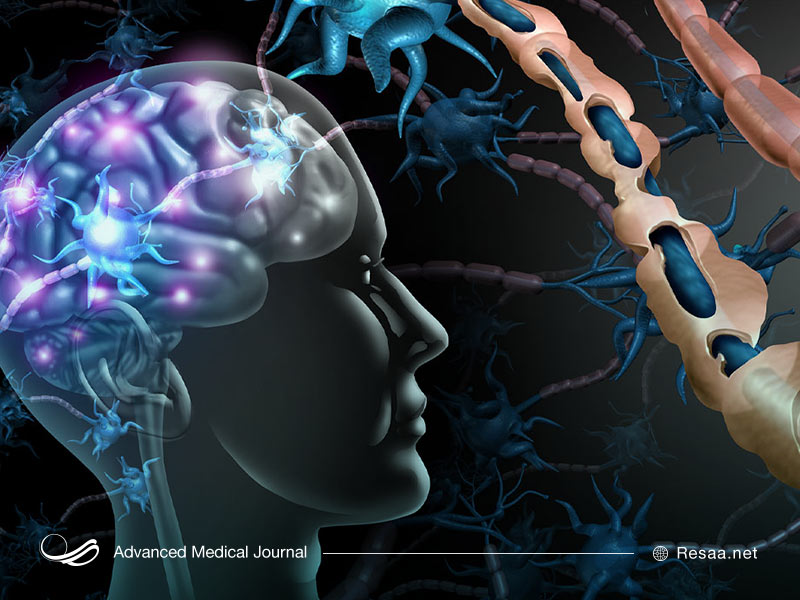 علائم و نشانه های ام اس