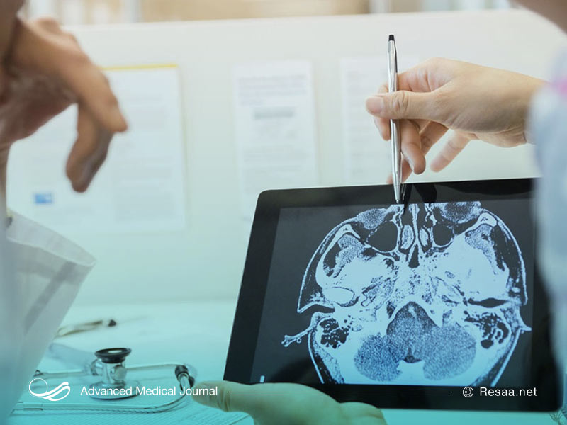 متخصص مغز و اعصاب