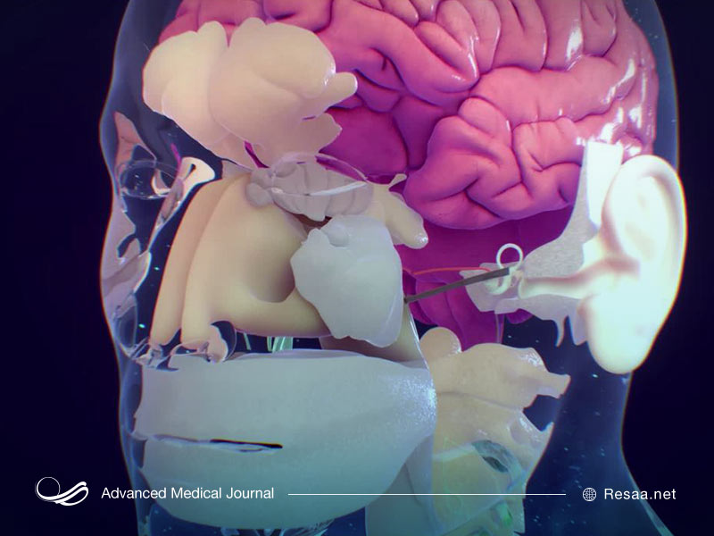 عوارض پولیپ بینی