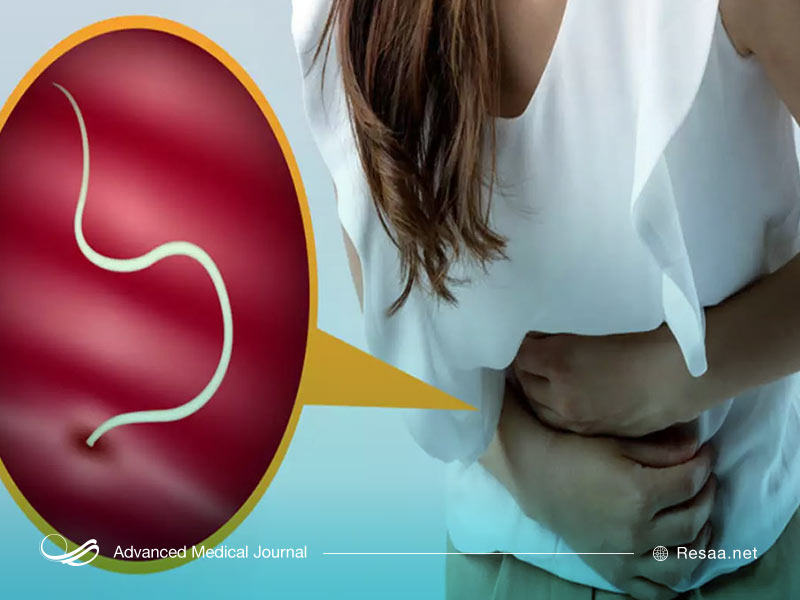 کرم انگل روده