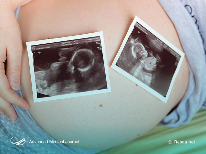 بارداری آسان