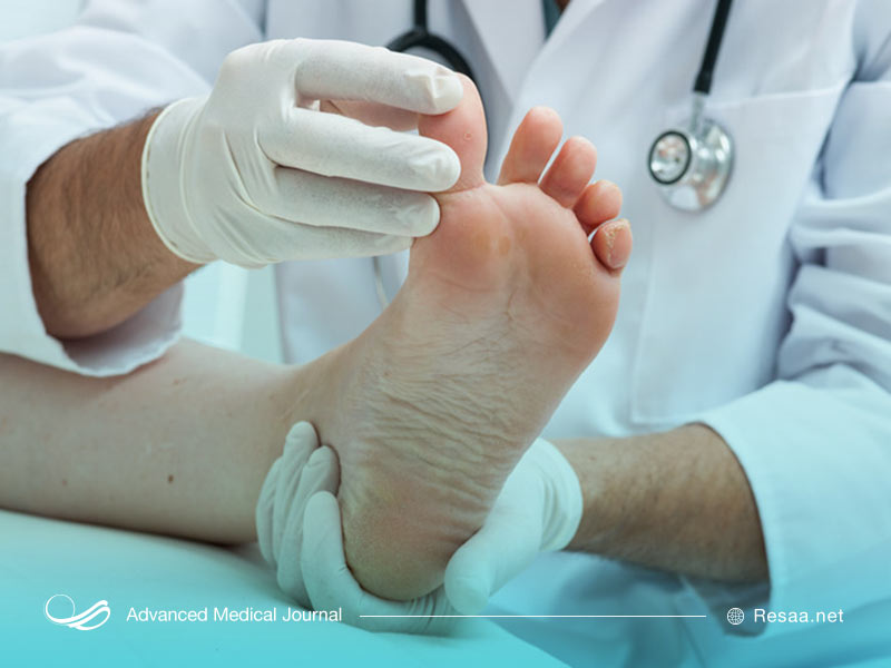 شناسایی سندروم پای بیقرار