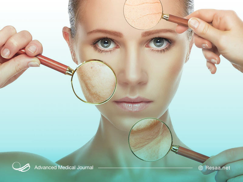 لکه های پوستی