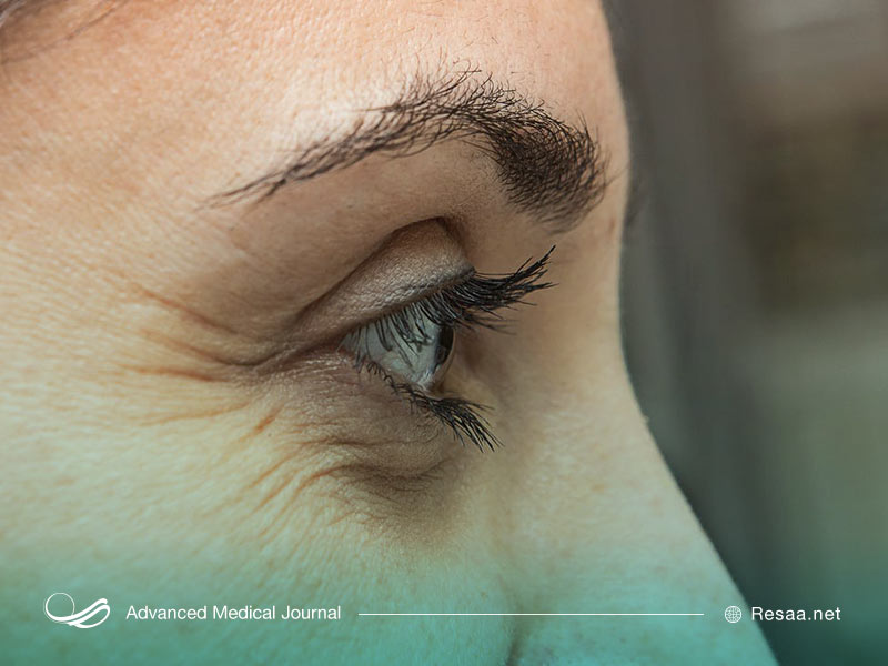 عوامل ژنتیکی موثر در پیری زودرس