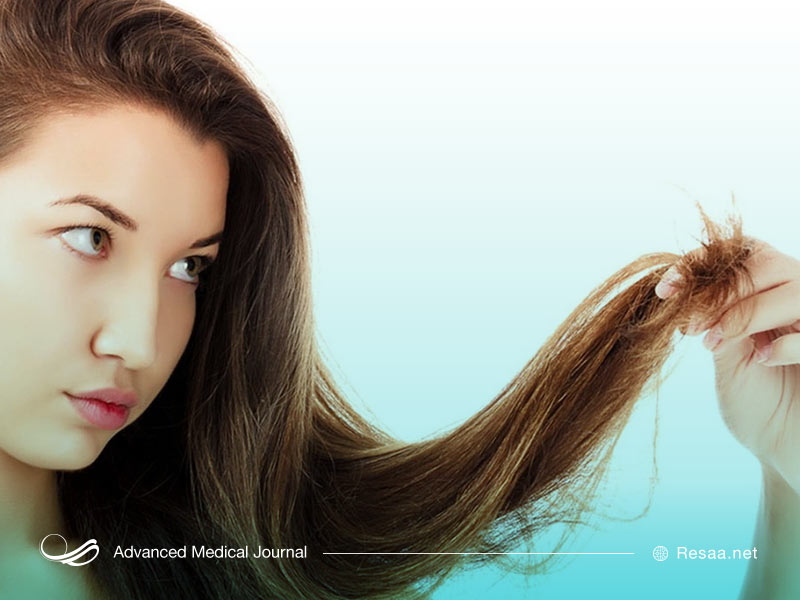 انواع موخوره