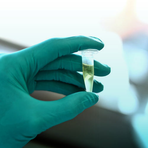 بیماری سفلیس چیست