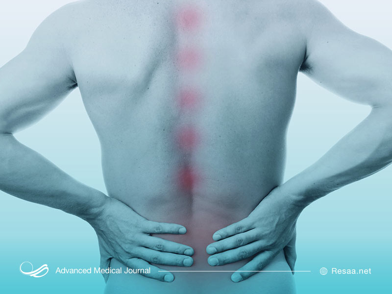 درد ستون فقرات