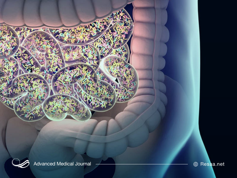 اسپوندیلیت