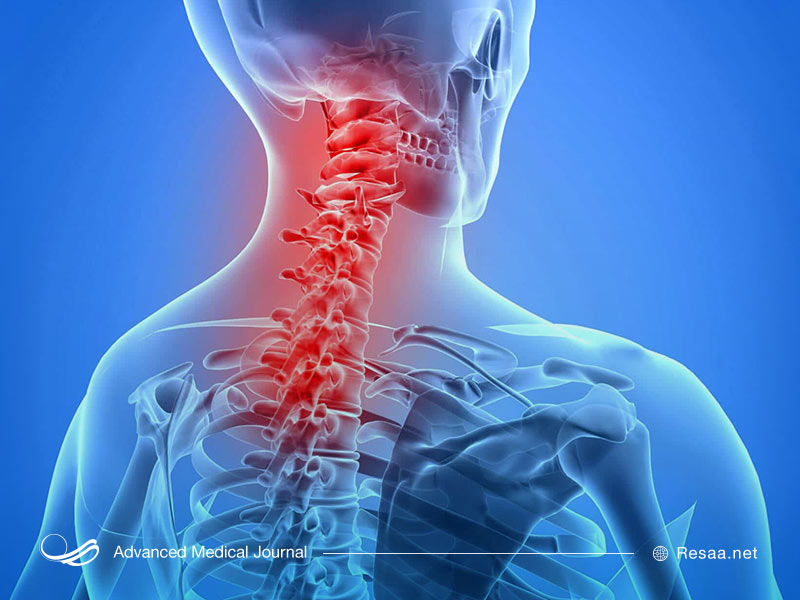 درد ستون فقرات و مهره های گردن
