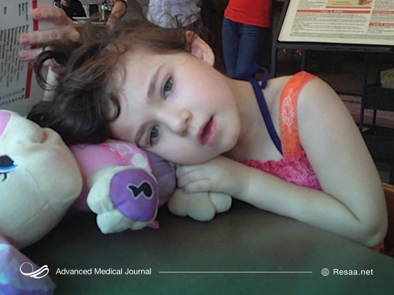 سندروم آیکاردی چیست