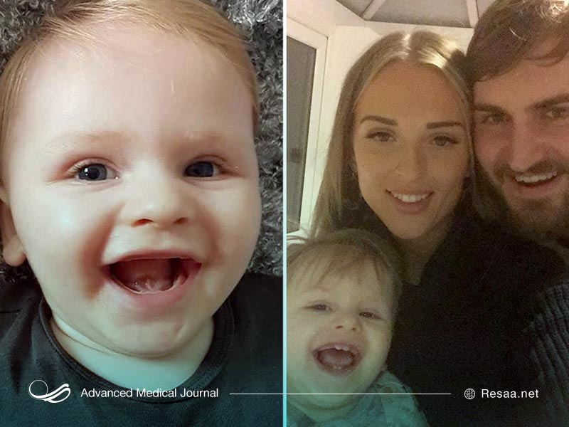 راه‌های تشخیص سندروم ایکاردی