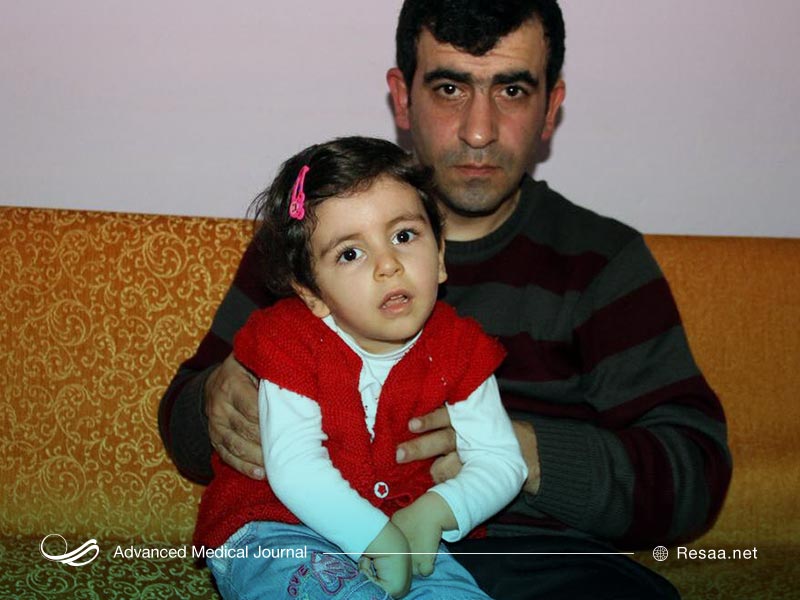 کودکی دچار سندروم ایکاردی