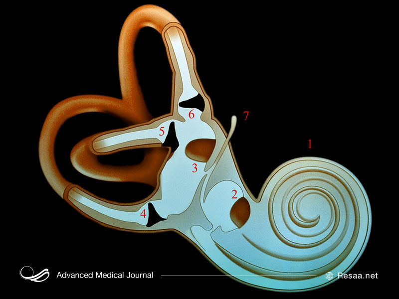 درمان مینیر با سمعک