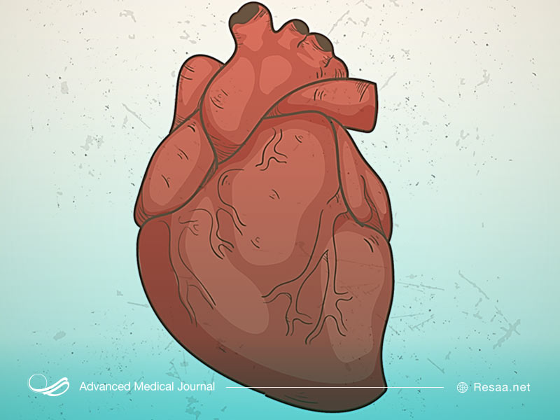 نارسایی قلب در اثر میوکاردیت