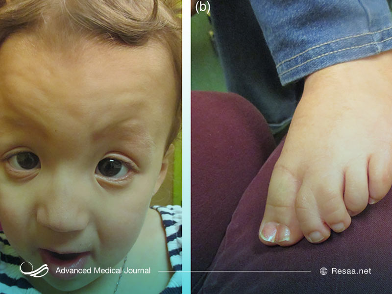 این بیماری می‌تواند کشنده باشد