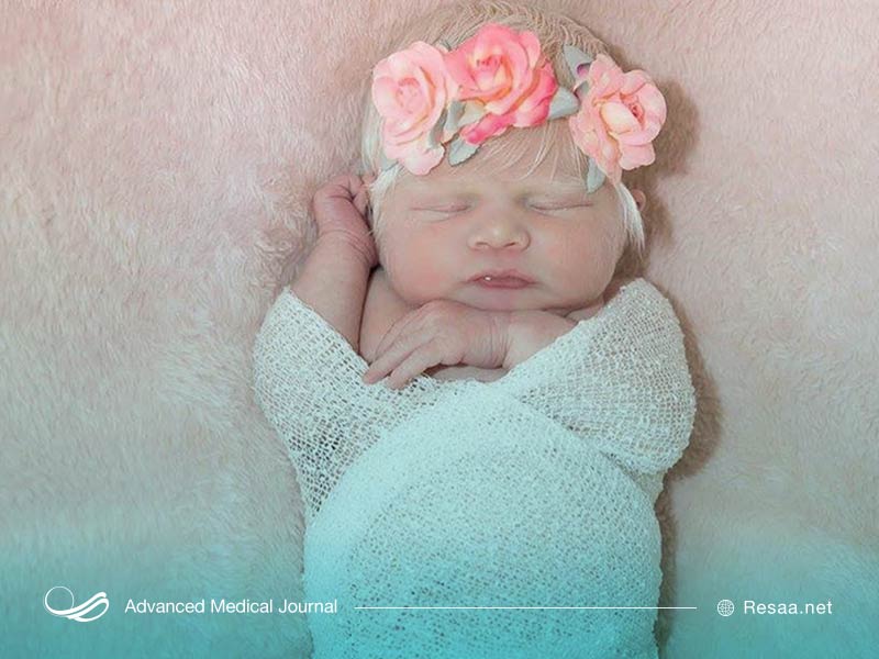 کنترل علایم البینیسم