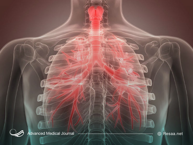 انواع برونشیت