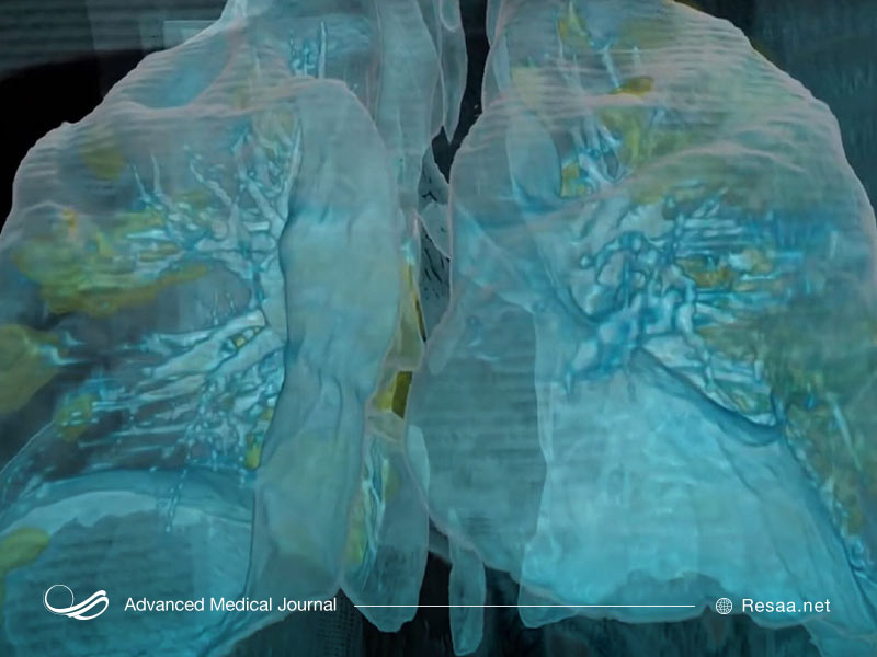 ساختار ریه را بشناسیم