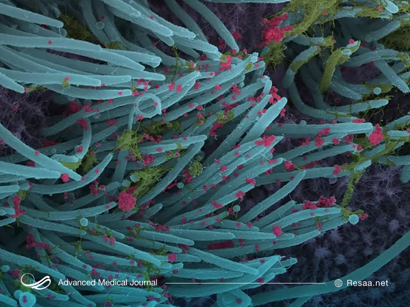 سی تی اسکن ریه