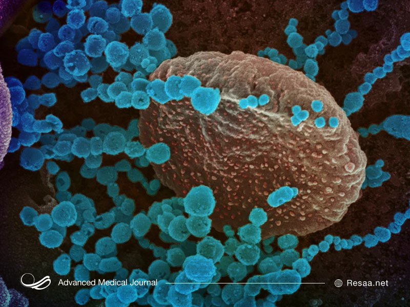 ذات الریه و درگیری ریه با کرونا