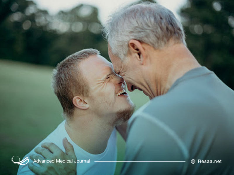 دلیل سندروم داون