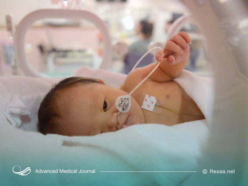 نشانه های سندروم داون