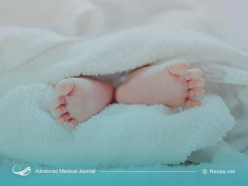 اختلالات نوزادی