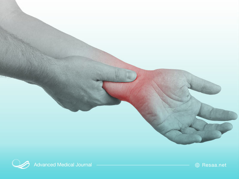 درد مچ دست