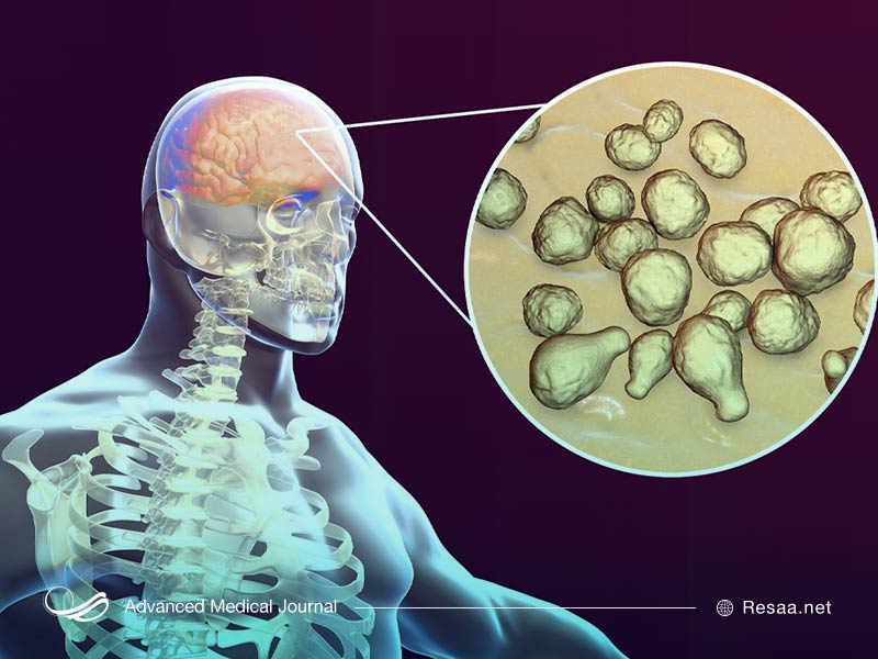 درمان التهاب گلو