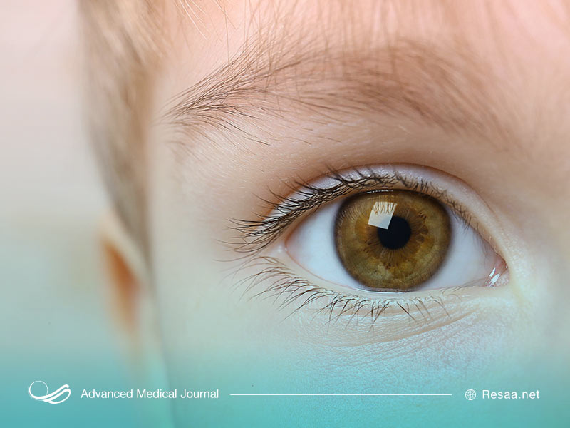 عفونت یا خالکوبی میتواند باعث بروز این بیماری شود