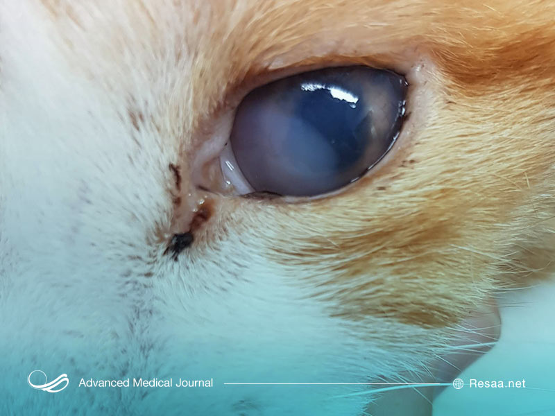 بیماری یوییت انواع مختلفی دارد