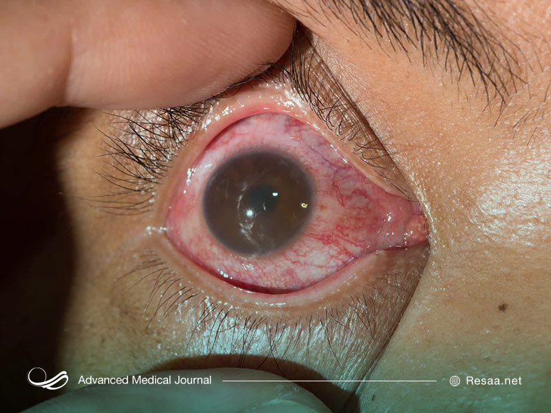 یوییت منتشره