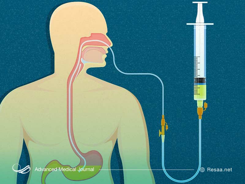 بیماری ویپل