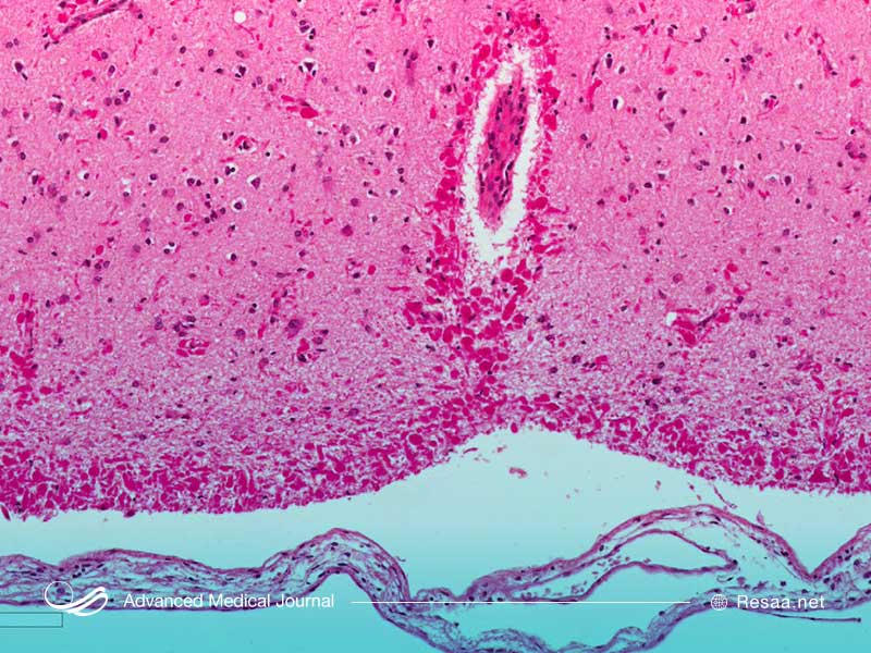 تاثیر الکساندر بر کودکان