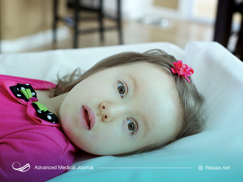 الکساندر علائم مختلفی دارد