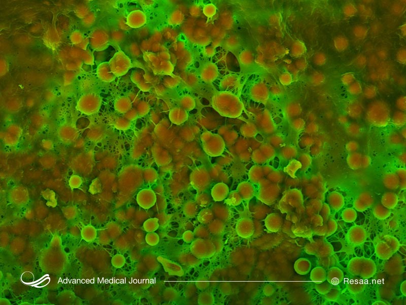 تجمع کلسیم در بدن