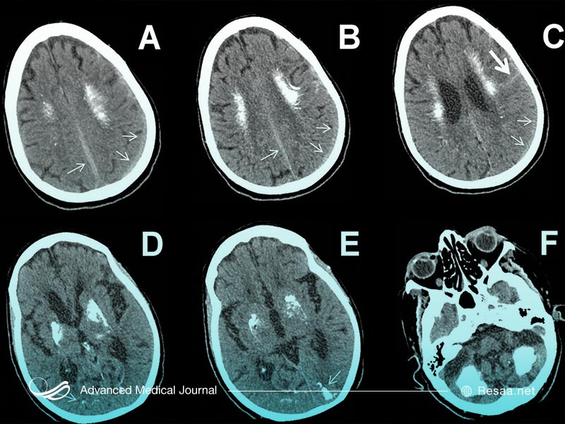 تصویر نمونه برداری