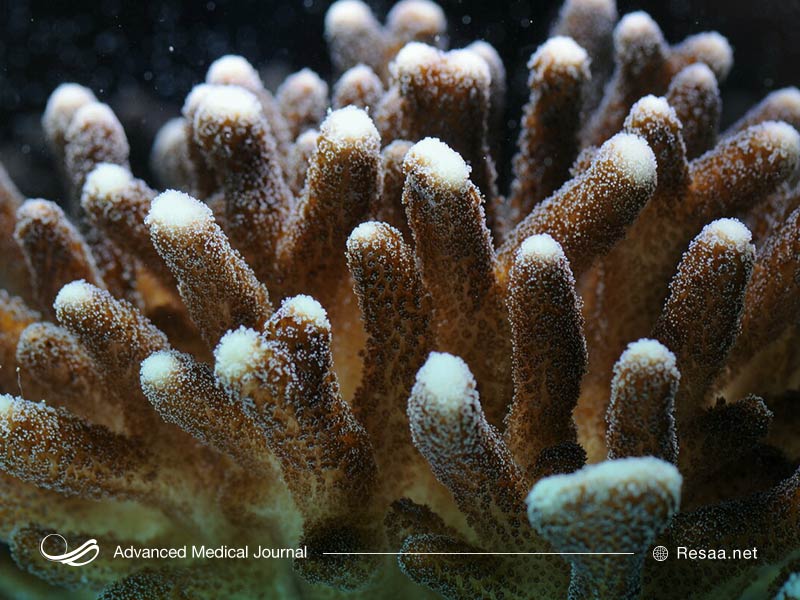 اختلال عملکرد اندامها