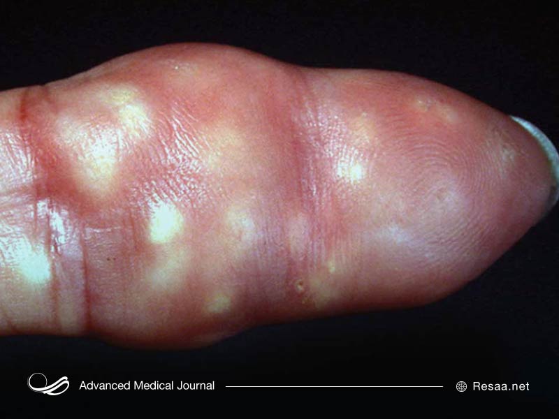 اختلالات بافتها