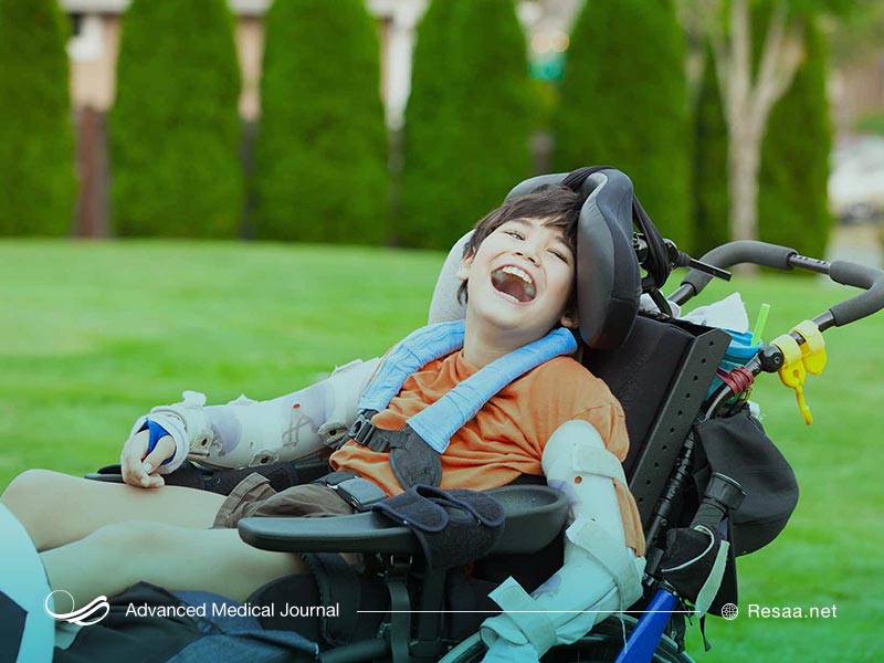 فلج مغزی چیست؟