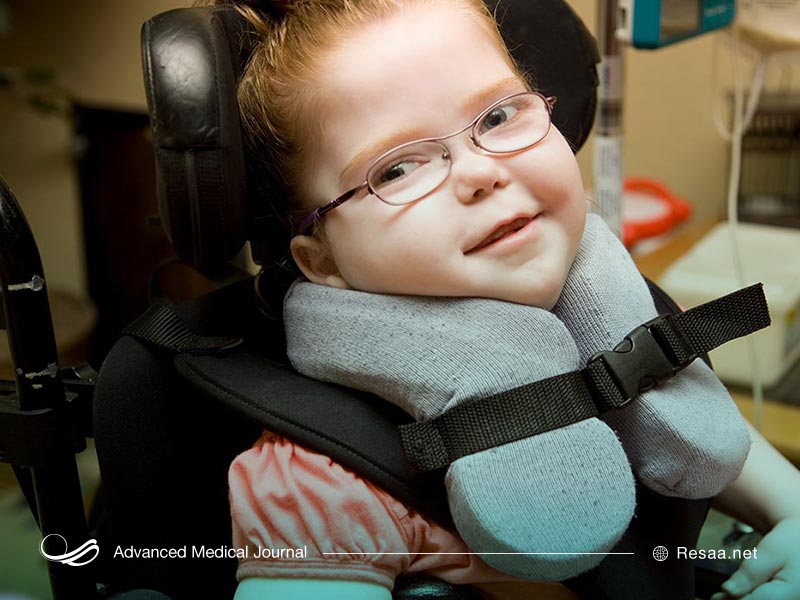 اختلالات مغز