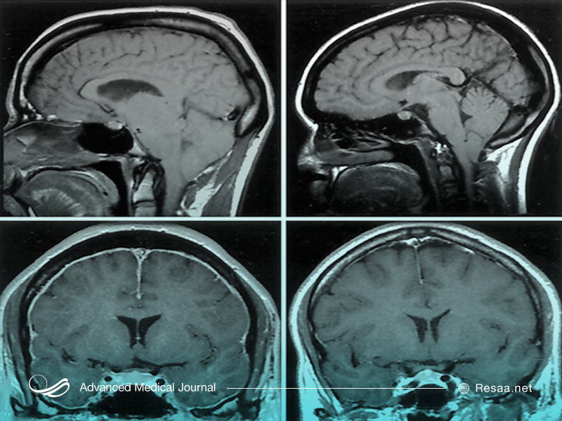 انواع کیاری